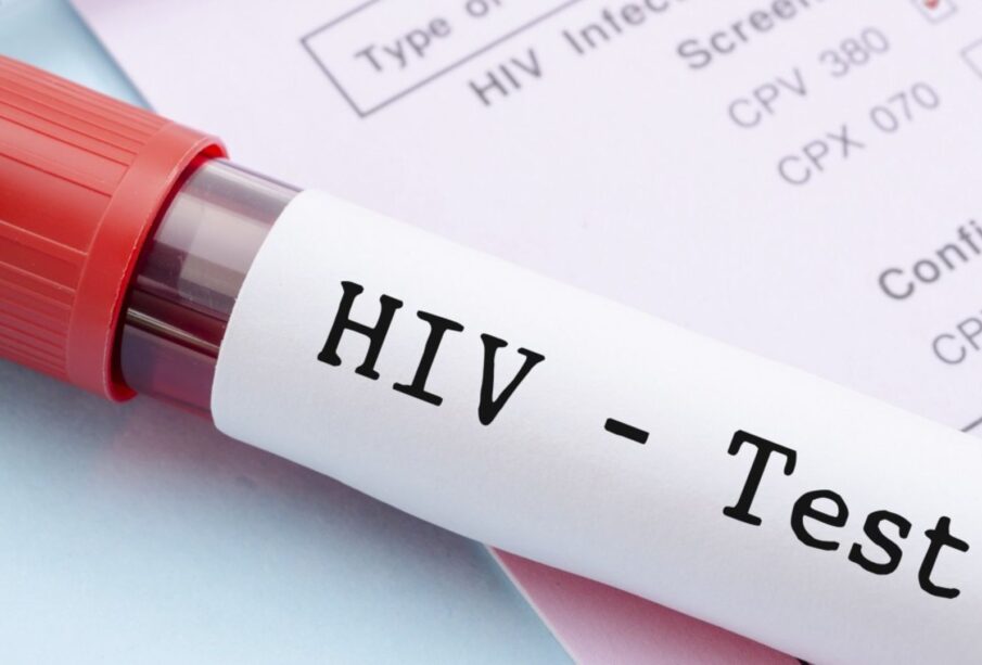 Govt steps up HIV/AIDS interventions