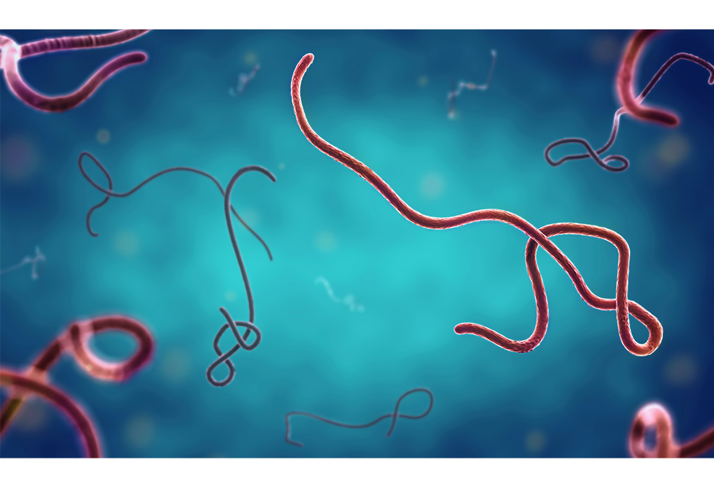 Tanzania intensifies measures against Ebola threat now affecting its neighbours