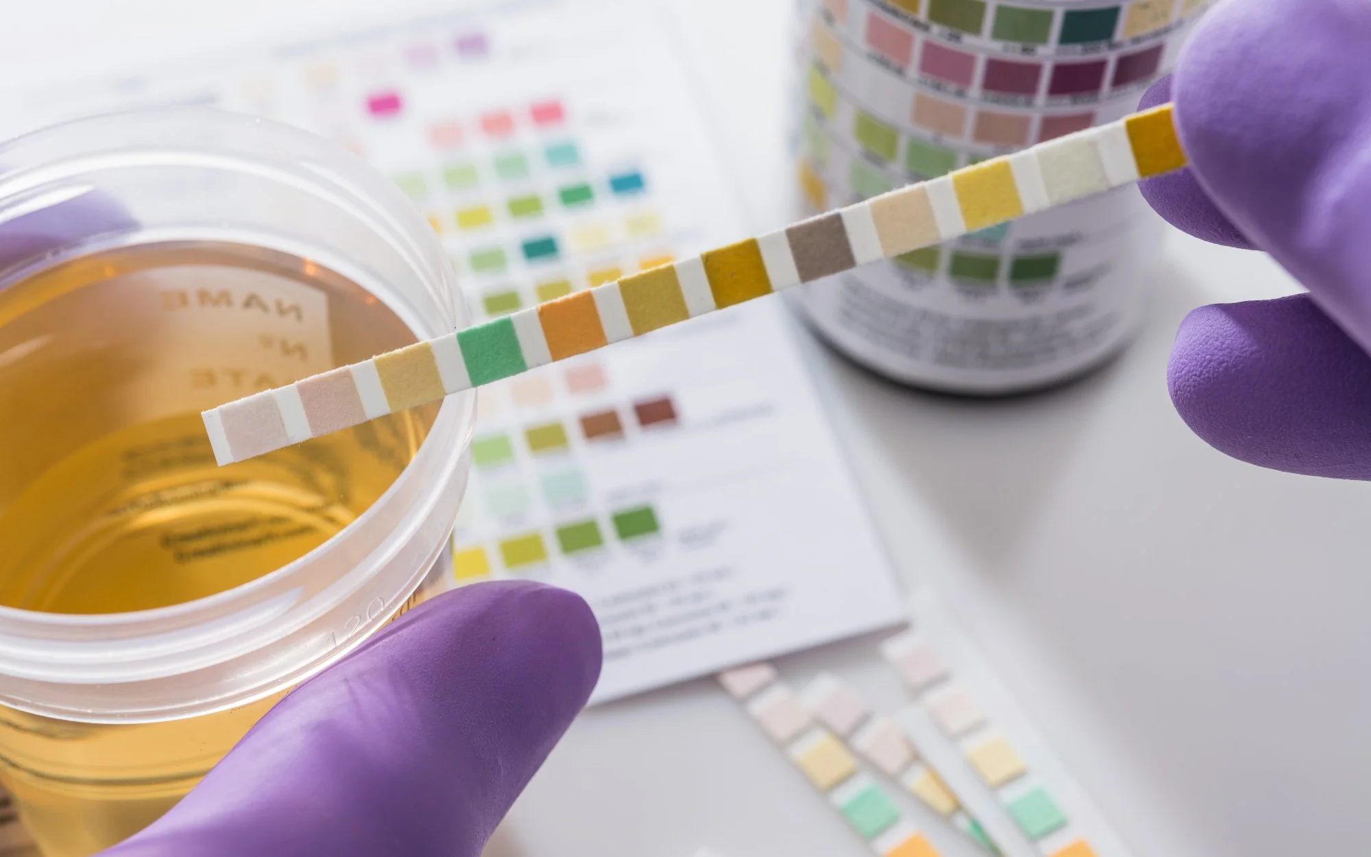 Rapid diagnostics bring innovation closer to Tanzanian patients